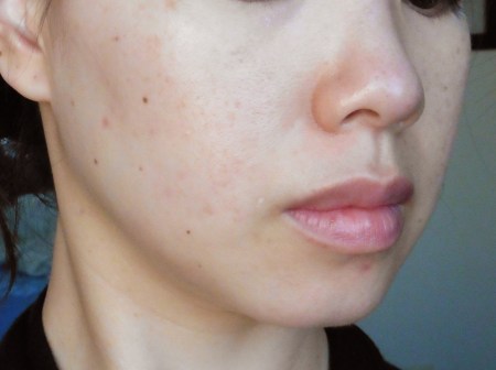 f3a94-09before-rightside