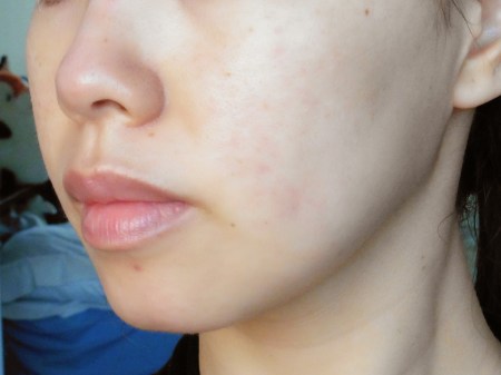 ffd2a-10before-leftside