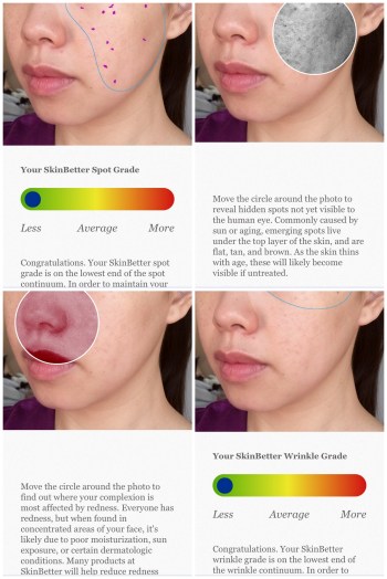 01 SkinBetter Skin Analyzer App Review