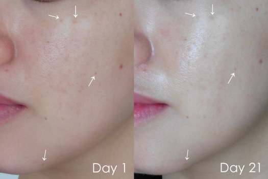 05 Before After 3 weeks Shark Sauce-left